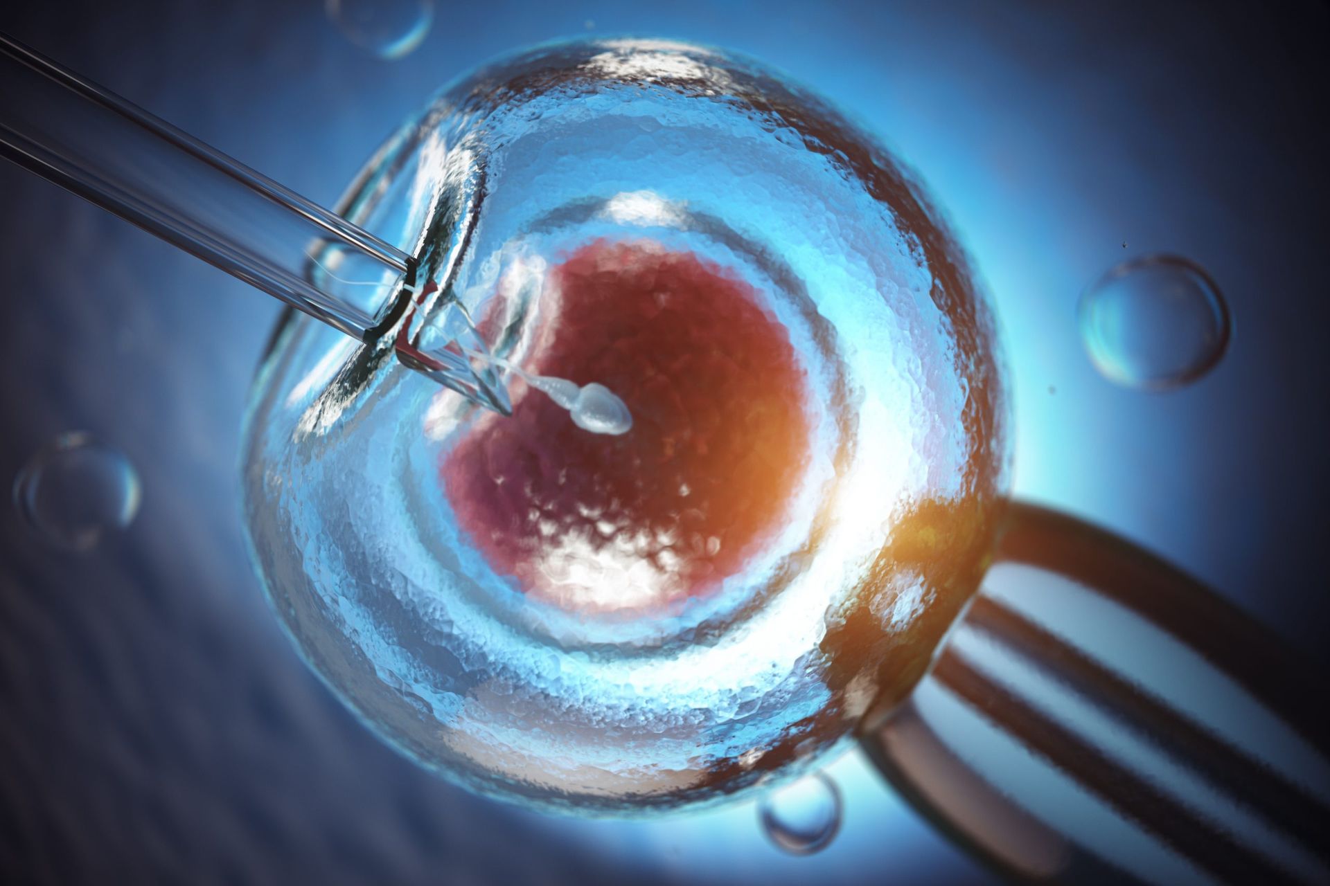 🧬✨ Intracytoplasmic Sperm Injection (ICSI): The Ultimate Guide
